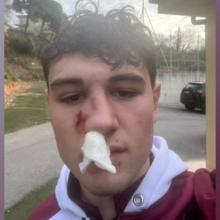 Garabello dopo il colpo subito