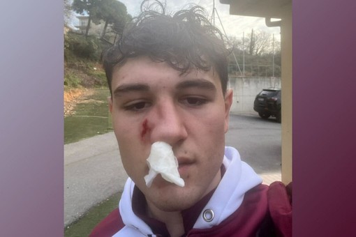 Garabello dopo il colpo subito